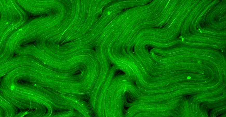 A fluorescence microscope image of one kind of active matter being studied. Image courtesy of Amanda Tan, UC Merced